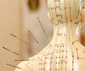 Acupuntura